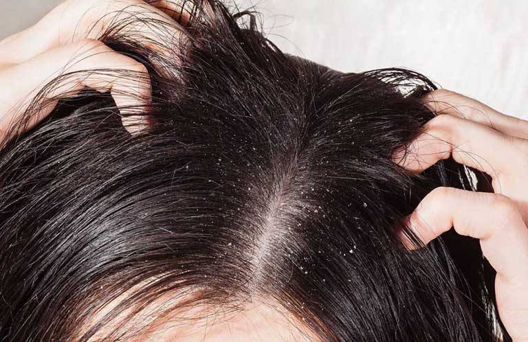 Review So sánh 2 loại Dầu gội đất sét Clayge Shampoo SR & Clayge Shampoo M 4 gau